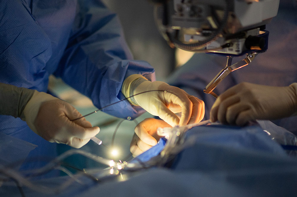 Membrane Epi-Rétinienne